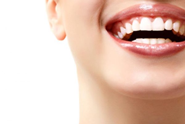 tooth sensitivity when whitening