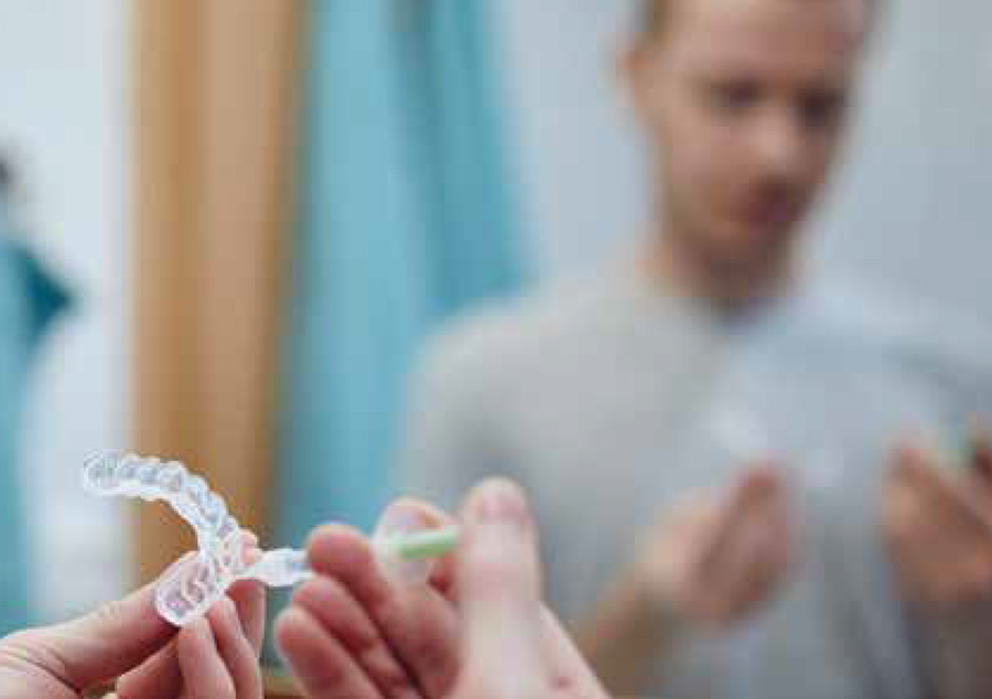 The dangers of illegal tooth whitening SDI Pola